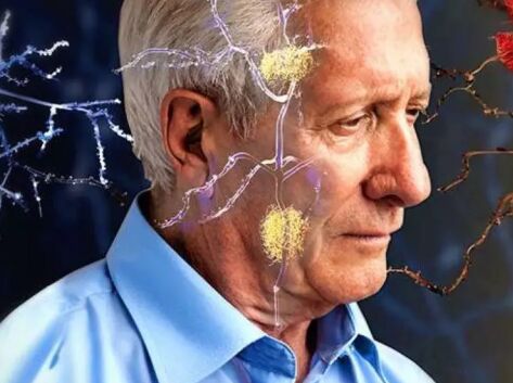 老年痴呆症的表现特征有哪些